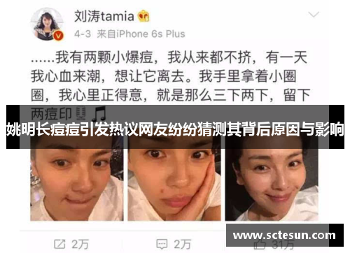 姚明长痘痘引发热议网友纷纷猜测其背后原因与影响